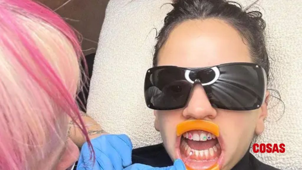 La Rosalía se implanta "grillz"
